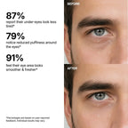 Hydrating Eye Rescue Serum – Lightweight Under Eye Care for Dark Circles & Fine Lines